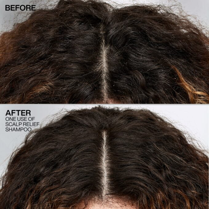 Redken Scalp Relief Dandruff Control Shampoo 250ml Halo Hair & Skin - rosehipskincare.com.au